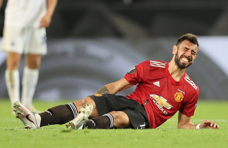 ảnh chế Bruno Fernandes 17