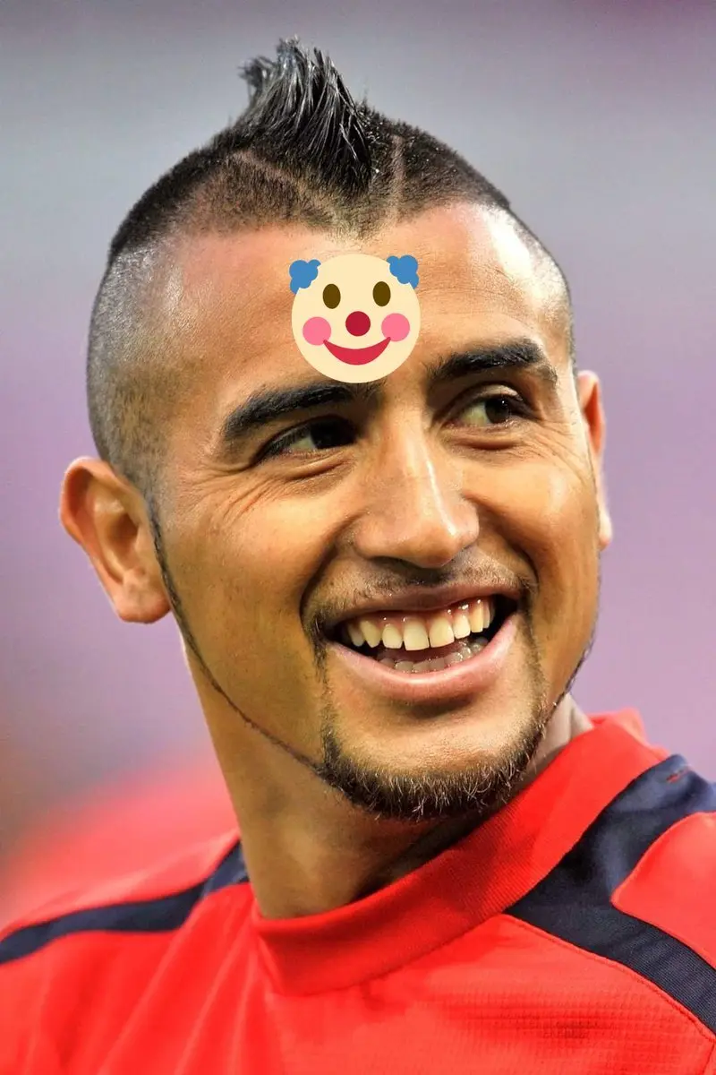 ảnh chế Arturo Vidal 12 ảnh chế Arturo Vidal 12