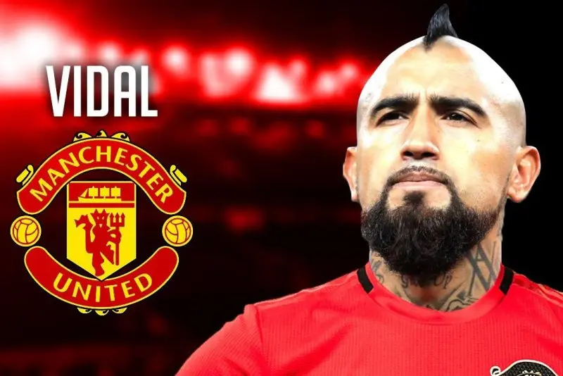 ảnh chế Arturo Vidal 22 ảnh chế Arturo Vidal 22