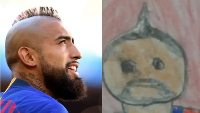 ảnh chế Arturo Vidal 36 ảnh chế Arturo Vidal 36