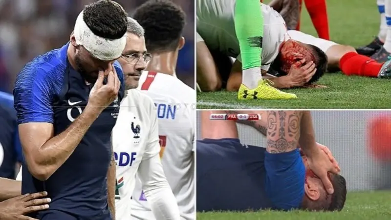 ảnh chế Olivier Giroud 27