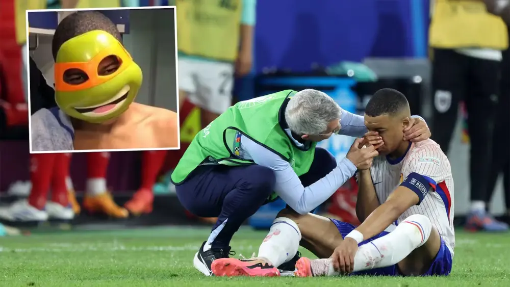 ảnh chế Kylian Mbappé 38 ảnh chế Kylian Mbappé 38