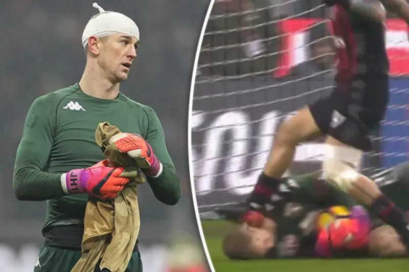 ảnh chế Joe Hart 12