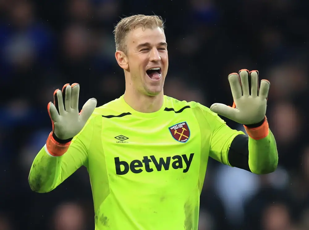 ảnh chế Joe Hart 3