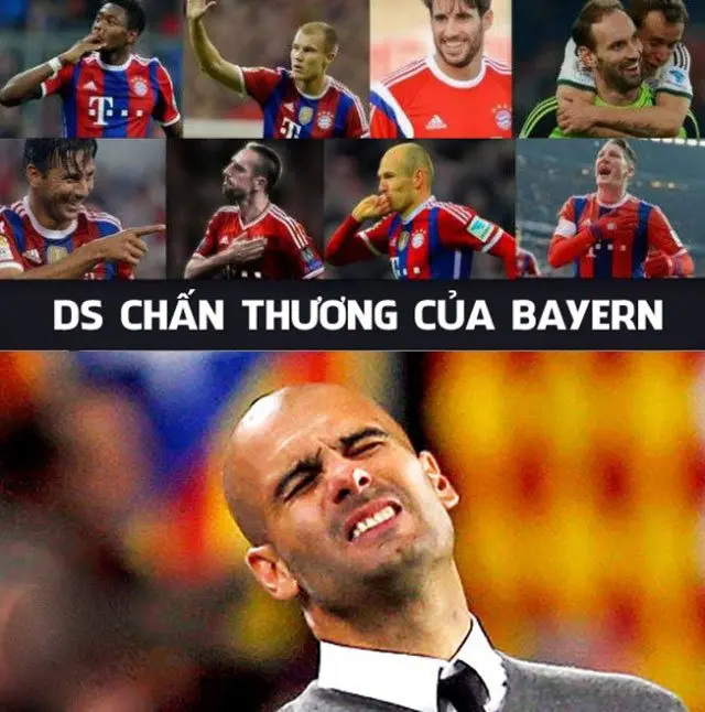 ảnh chế Joe Hart 26