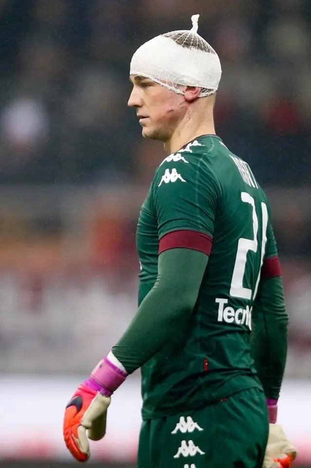 ảnh chế Joe Hart 29