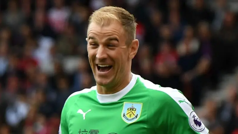 ảnh chế Joe Hart 39