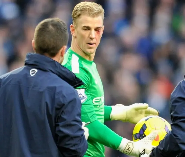 ảnh chế Joe Hart 40