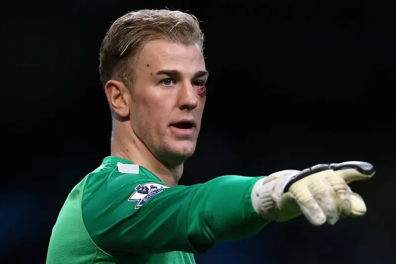 ảnh chế Joe Hart 41