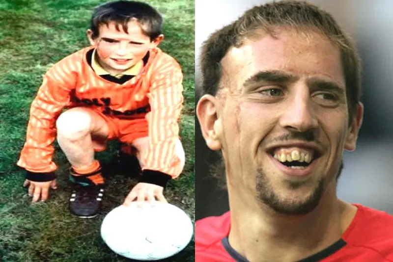 ảnh chế Frank Ribéry 46 ảnh chế Frank Ribéry 46