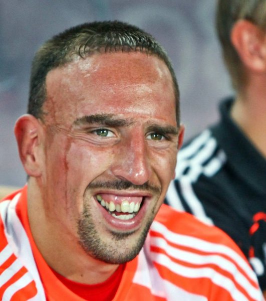 ảnh chế Frank Ribéry 33 ảnh chế Frank Ribéry 33