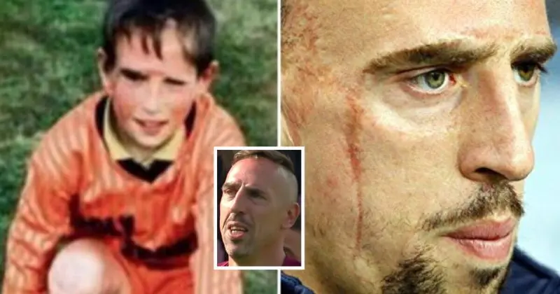 ảnh chế Frank Ribéry 19 ảnh chế Frank Ribéry 19