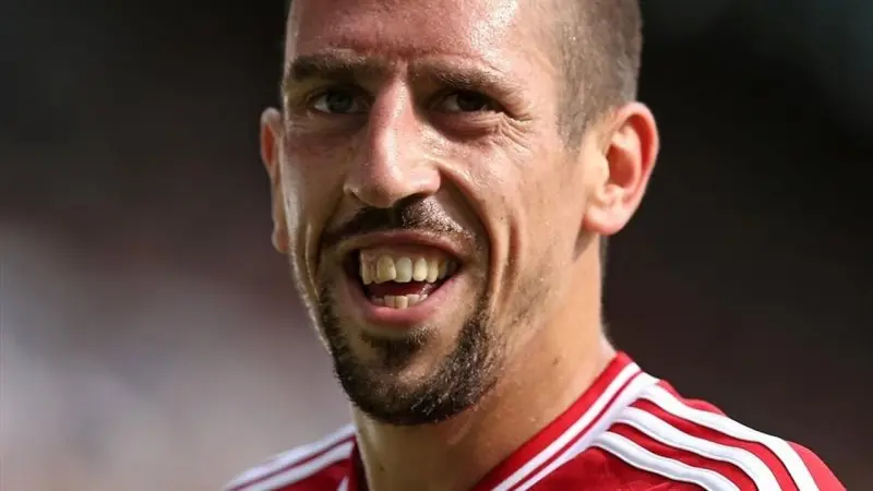 ảnh chế Frank Ribéry 16 ảnh chế Frank Ribéry 16