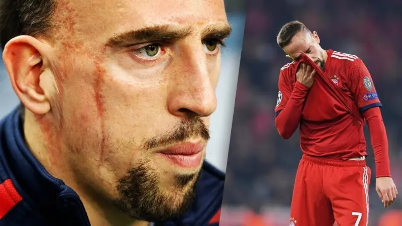 ảnh chế Frank Ribéry 42 ảnh chế Frank Ribéry 42