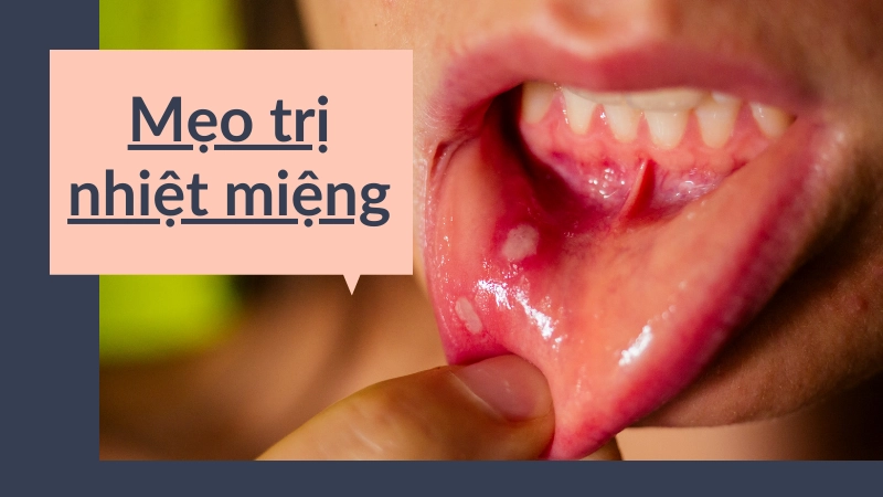 Súc miệng nước muối tinh hoặc nước cốt chanh